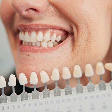 a woman smiling with a shade chart in front of her teeth