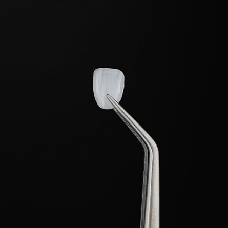 Veneer held with tweezers