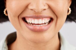 Woman with veneers smiling
